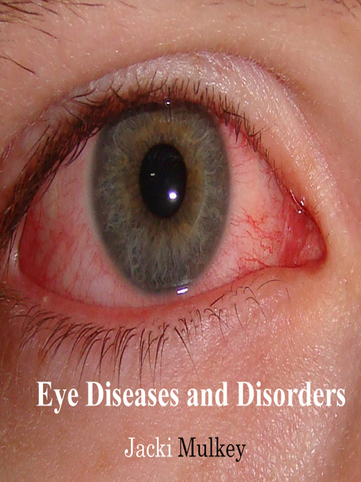 Title details for Eye Diseases and Disorders by Jacki Mulkey - Available